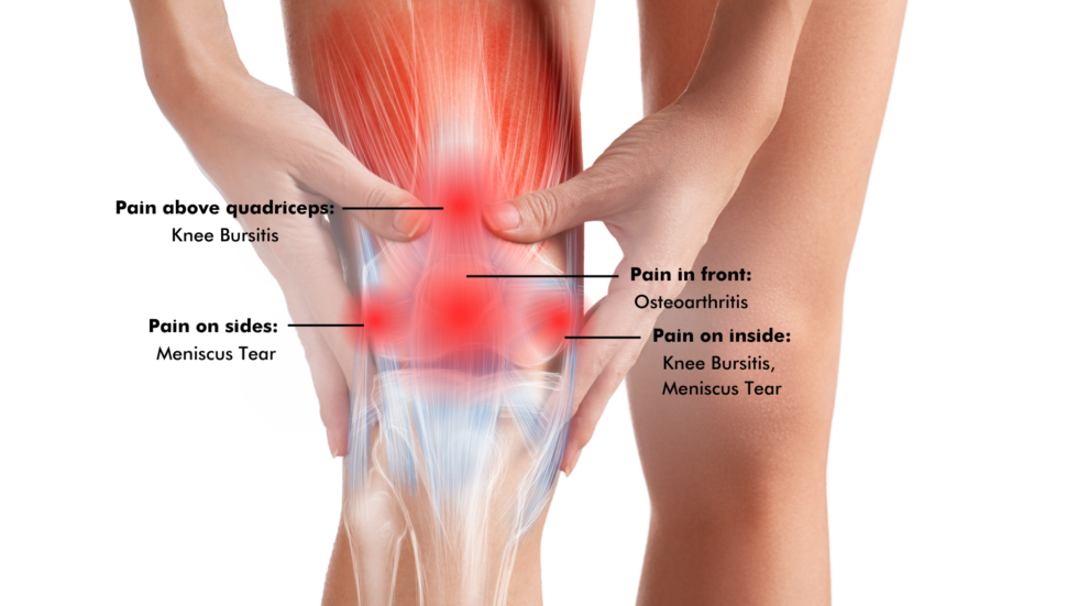 Common Causes of Knee Pain