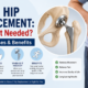 Total Hip Replacement: When Is It Needed? Signs, Causes & Benefits