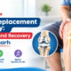 Knee Replacement Surgery Aligarh