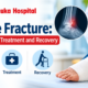 Ankle fracture symptoms, treatment and recovery guide