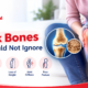 Signs of weak bones and bone health warning symptoms